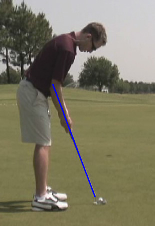 putting forearm plane alignment